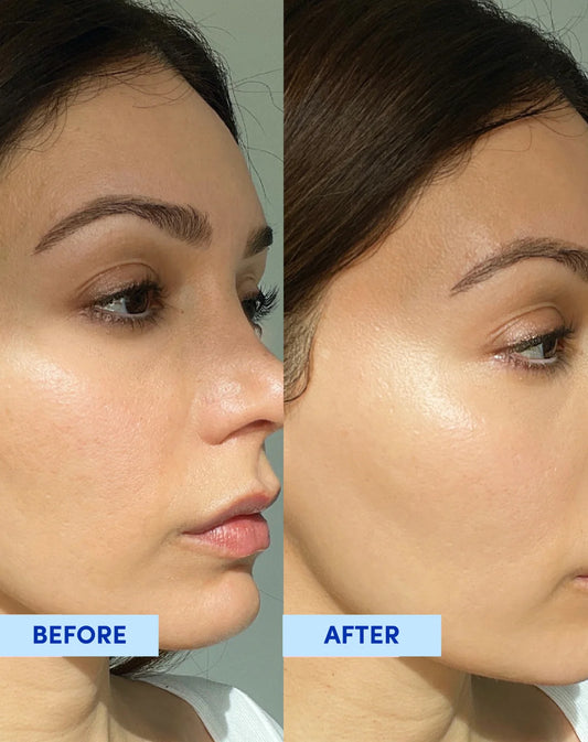 Rice Glow Serum Niacinamide<10% Glutathione<2%Vitamin-c 5%