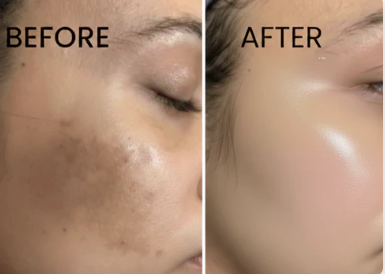7% Glycolic Acid Toner